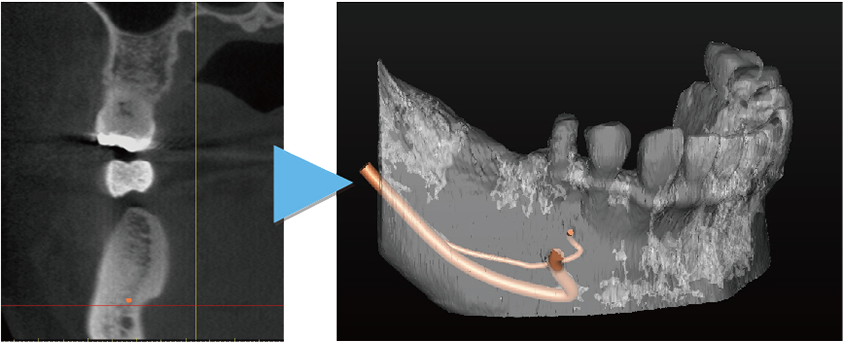 シンプラント プロとは 画像その1