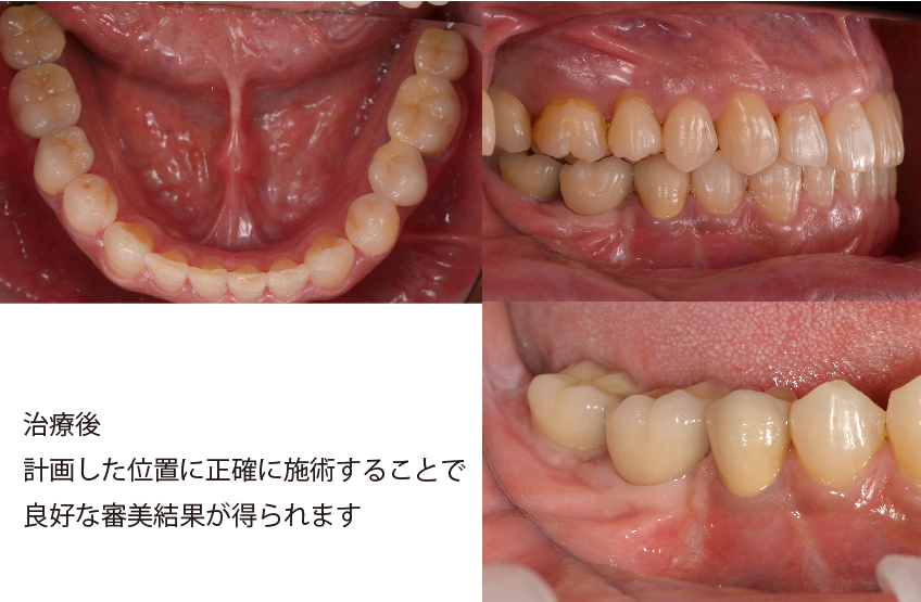 シンプラント プロとは 画像その3